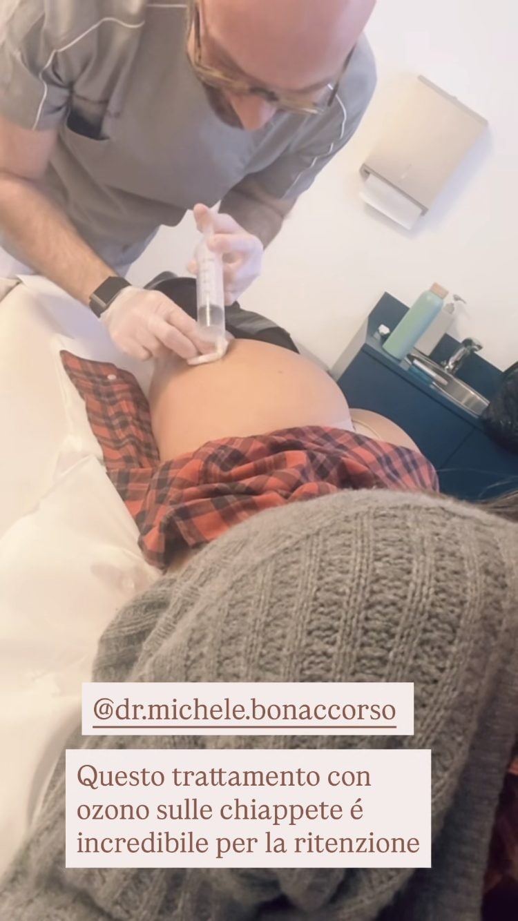 L’ozonoterapia praticata da Belén