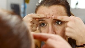 Aumentano i casi di acne tra i giovani, il dermatologo: "Si minimizza ma è vera sofferenza psicologica"