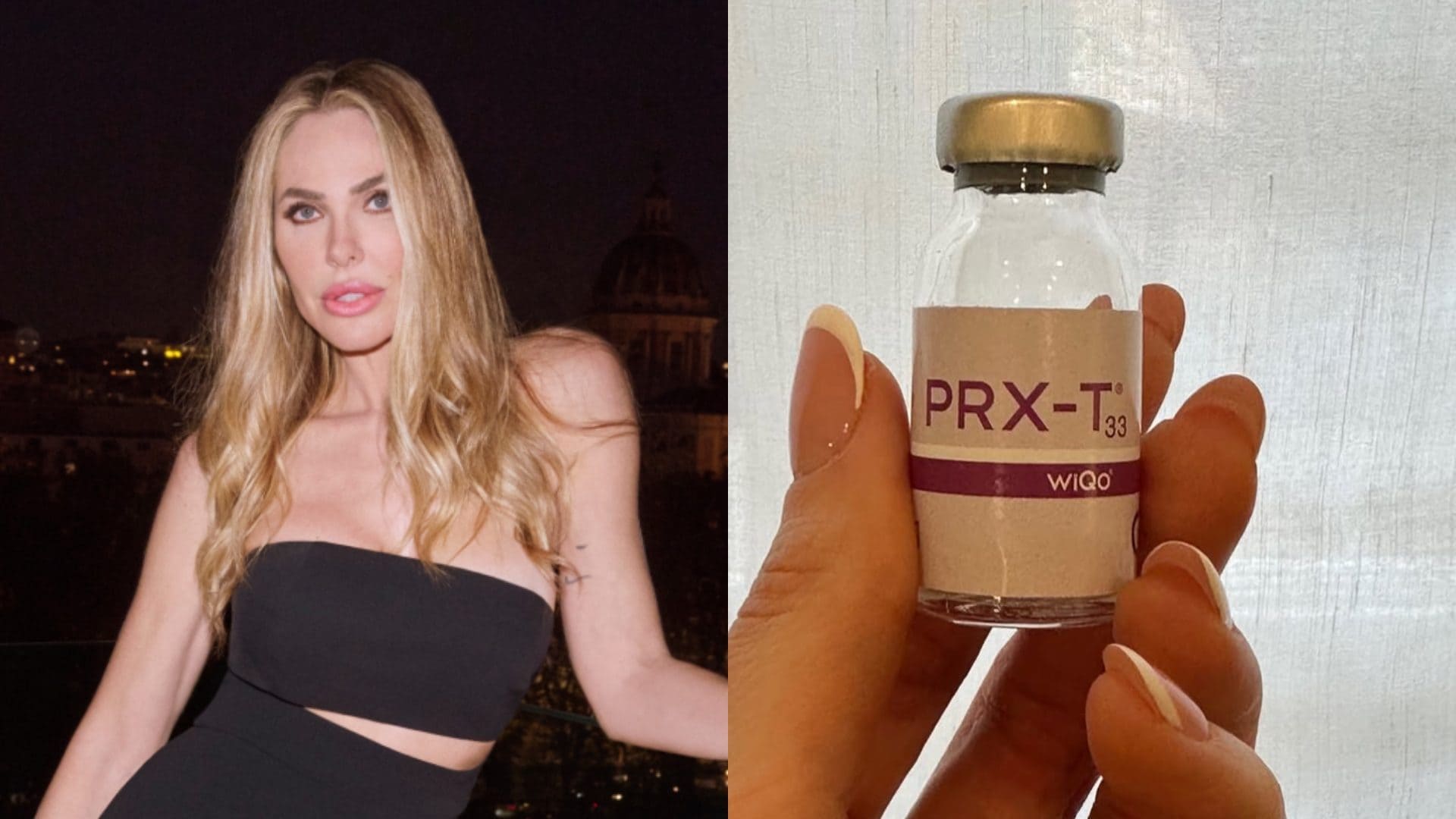 Lifting senza aghi o punture: qual è il trattamento viso a cui si è sottoposta Ilary Blasi