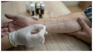 Allergie allo sport o all'acqua: un allergologo rivela le patologie più strane