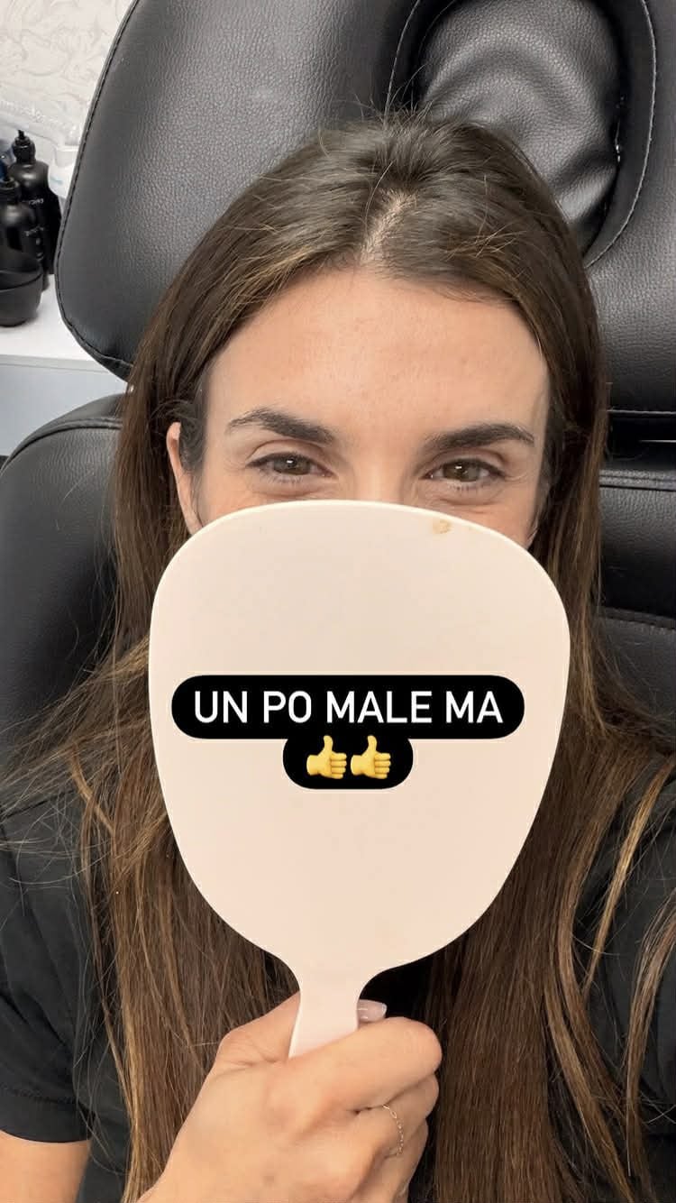 Elisabetta Canalis dopo il trattamento PRF
