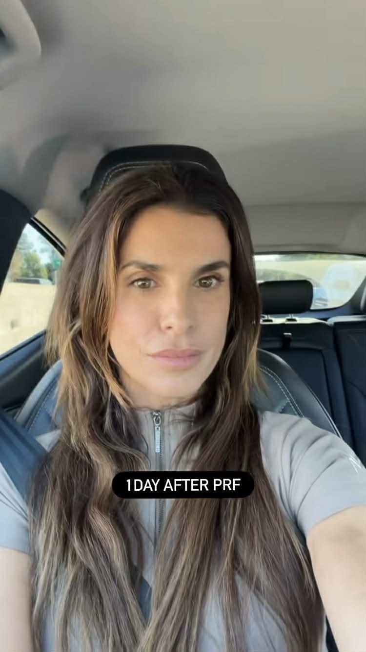 Elisabetta Canalis il giorno dopo