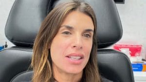 Cos'è il PRF, il trattamento per la pelle a base di sangue provato da Elisabetta Canalis