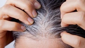 Si possono prevenire i capelli bianchi? La tricologa: "Stress e genetica non sono la causa"