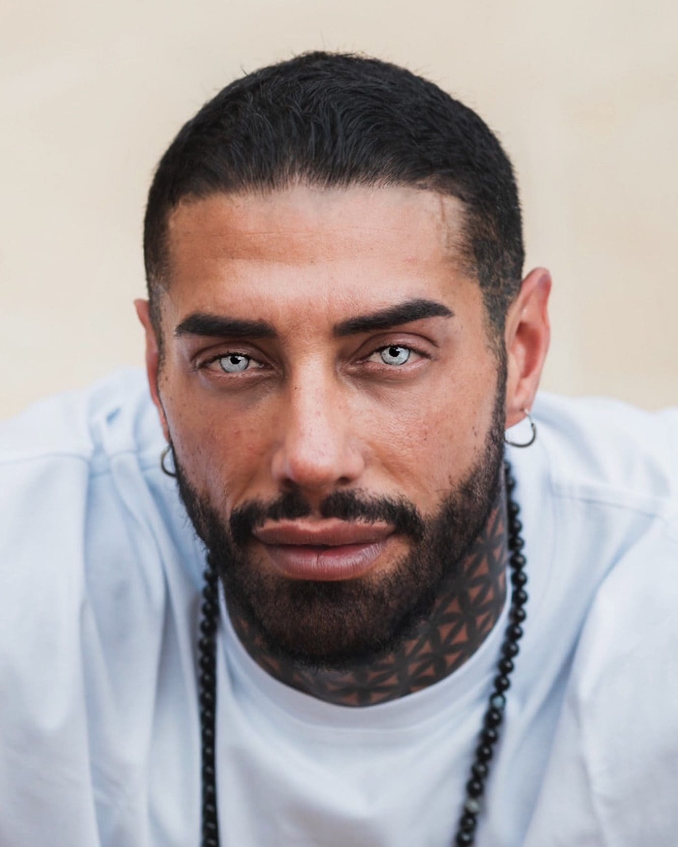 Francesco Chiofalo con i nuovi occhi azzurri