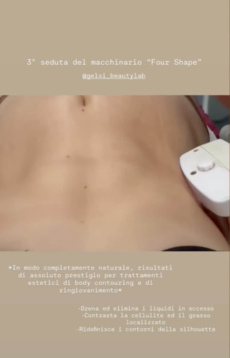 Chanel Totti alle prese col body contouring