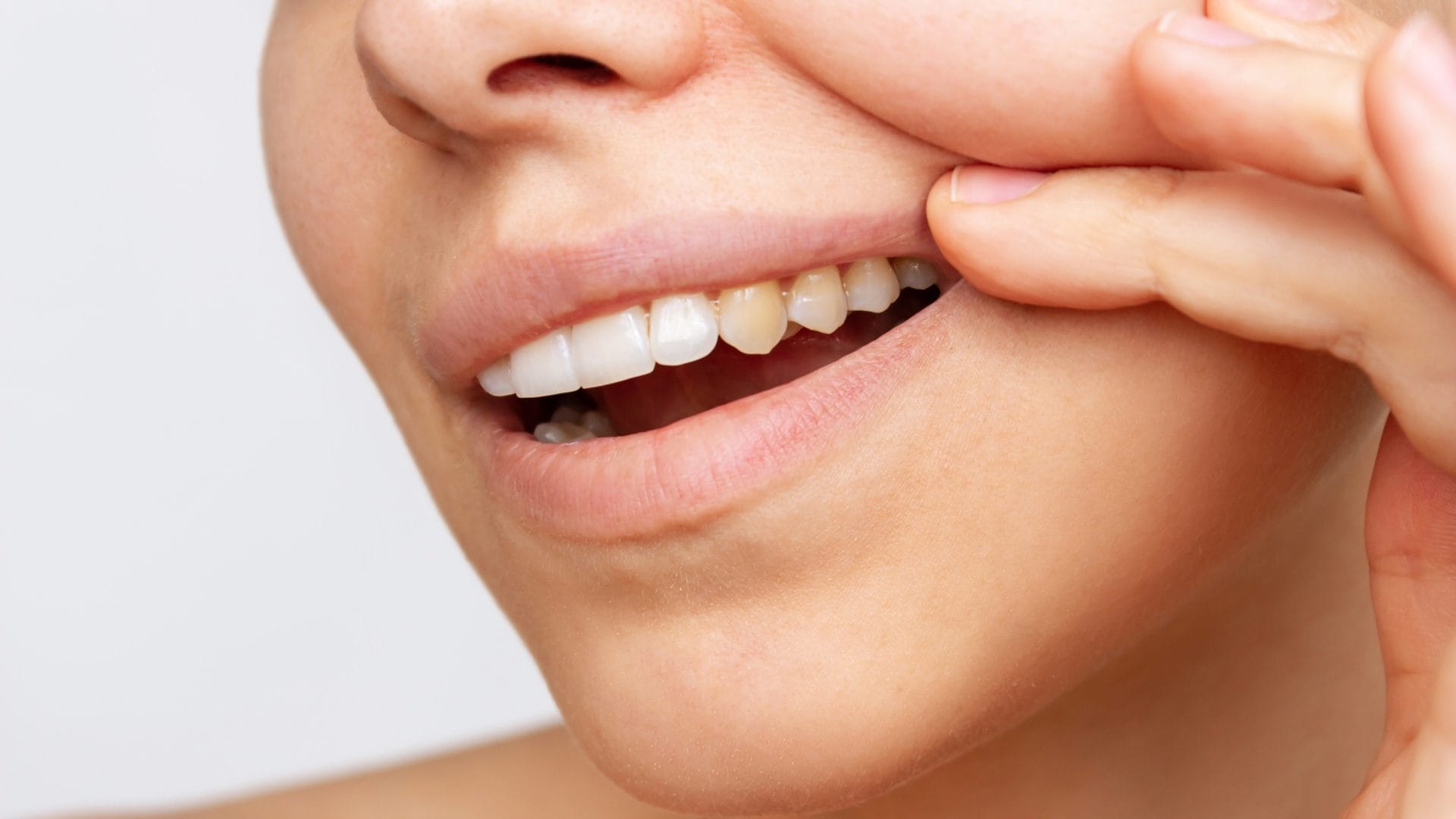 Macchie, patina gialla e sanguinamento, l'igienista Polizzi rivela cosa dicono i denti della nostra salute