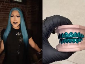 I nuovi denti d’oro di North West sono personalizzati e valgono quasi 30mila euro