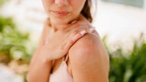 Dermatite atopica e psoriasi peggiorano in primavera, il medico Mercuri: "Lavarsi troppo aumenta l'irritazione"