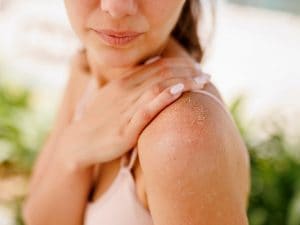 Dermatite atopica e psoriasi peggiorano in primavera, il medico Mercuri: “Lavarsi troppo aumenta l’irritazione”