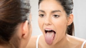 Cosa dice la lingua della salute, il patologo orale Abati: "I farmaci la rendono secca, le infezioni bianca o rossa"