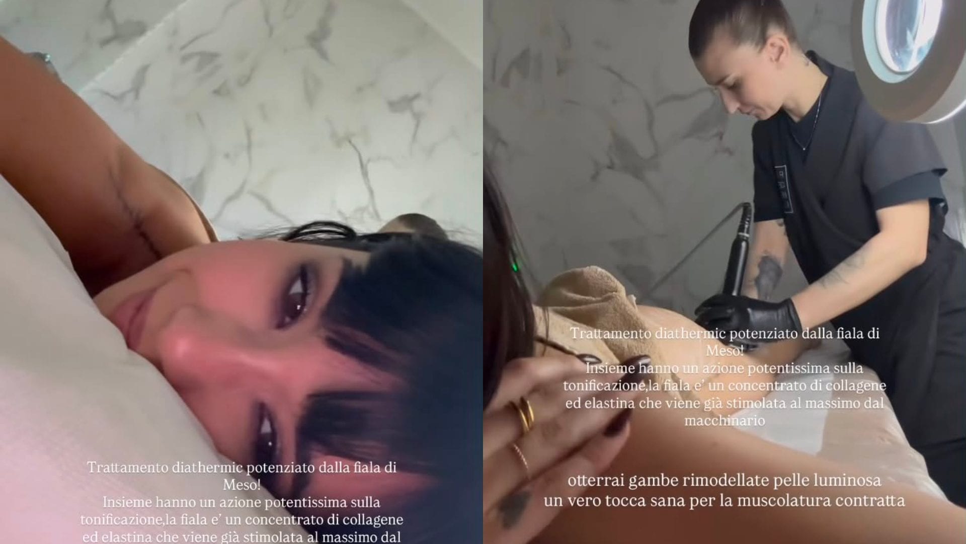 Martina Miliddi, il segreto delle sue gambe toniche è un trattamento innovativo a raggi infrarossi