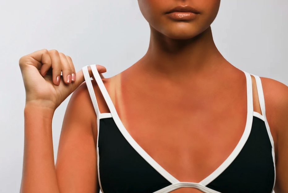 Tanmaxxing per abbronzarsi di più, Ines Mordente: "Pericoloso, la pelle ricorda e le conseguenze si pagano anni dopo"