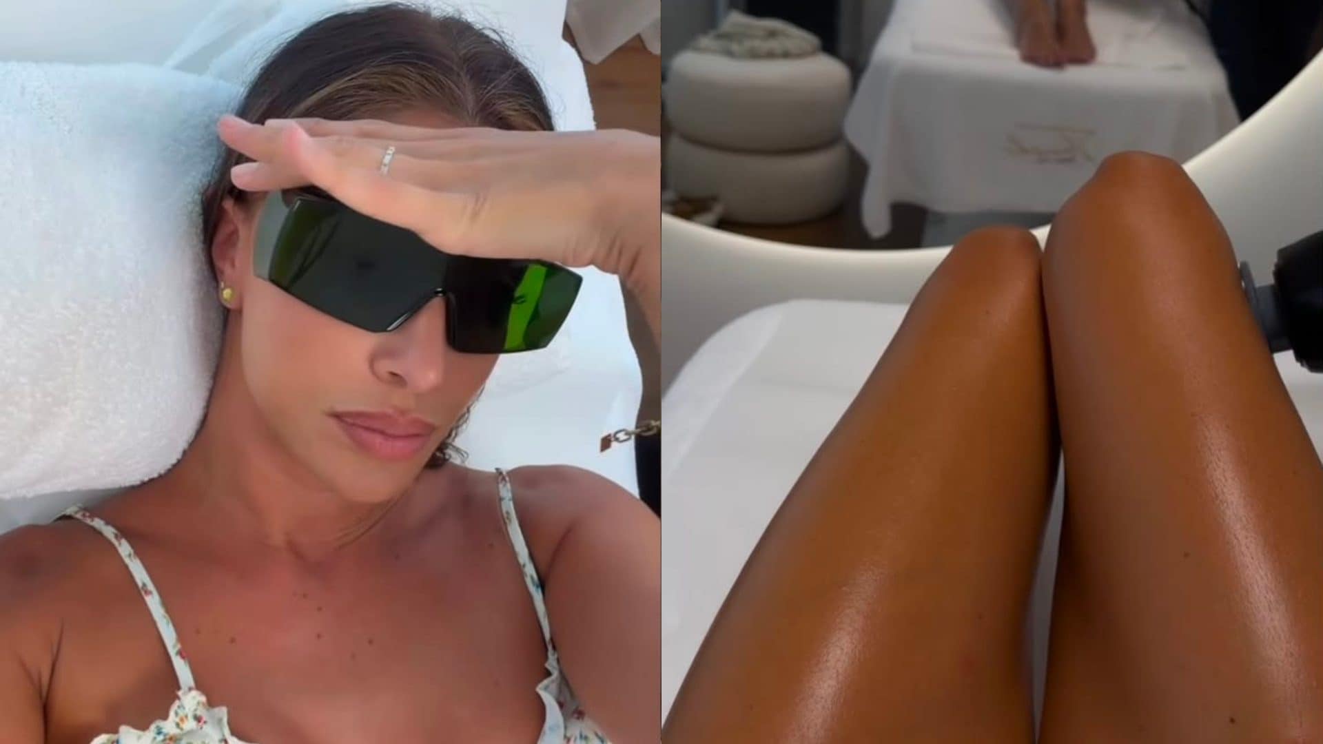 Il segreto delle gambe toniche di Belén: qual è il trattamento che combatte gli inestetismi