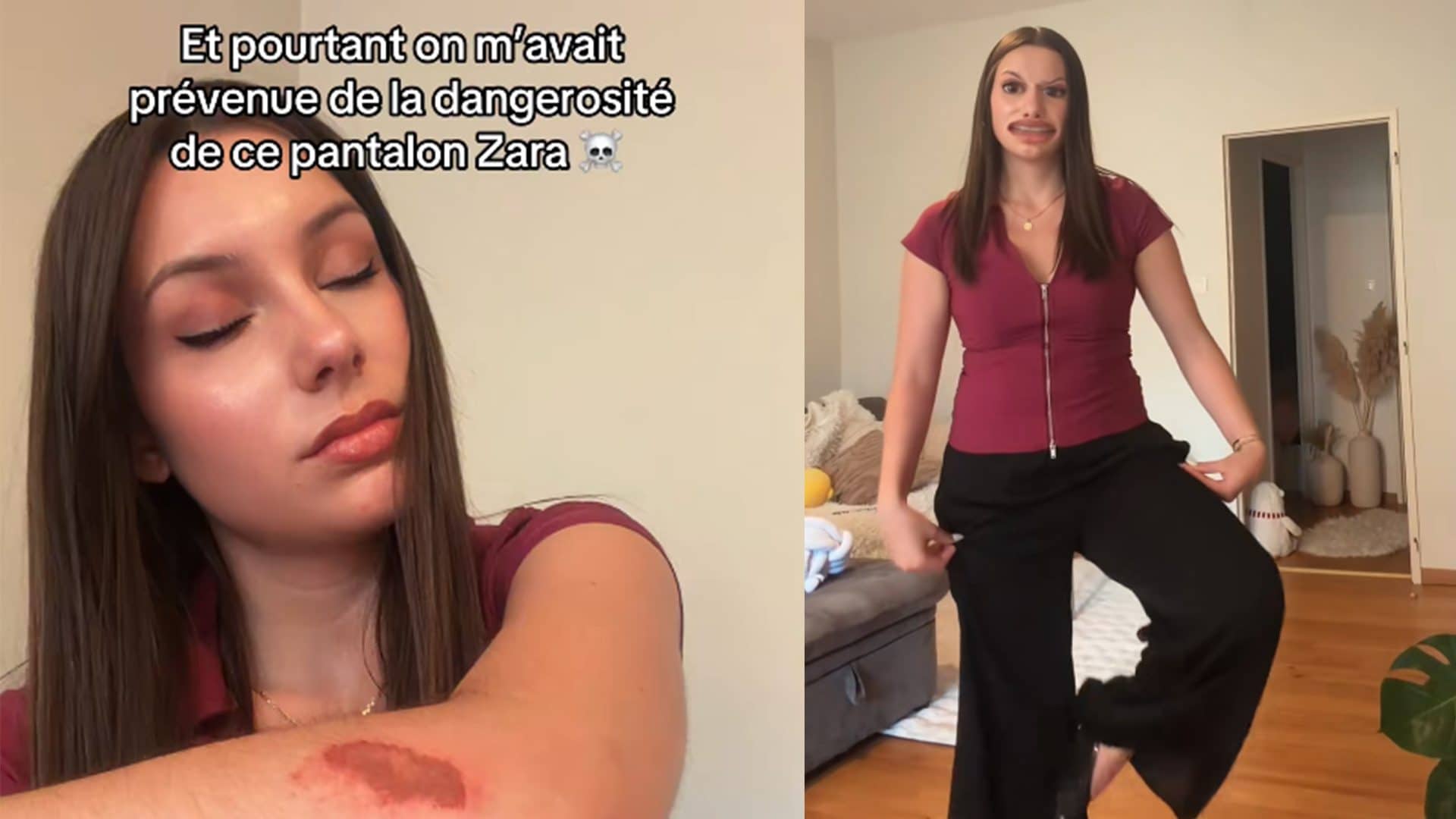 I pantaloni killer di Zara che fanno inciampare tutti: su TikTok le testimonianze tra lividi e fratture al ginocchio