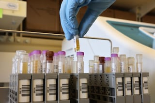 Tutti gli scenari in cui può evolvere la pandemia di Covid