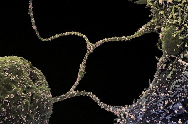 Particelle virali del coronavirus SARS–CoV–2 su cellule umane. Credit: NIAID