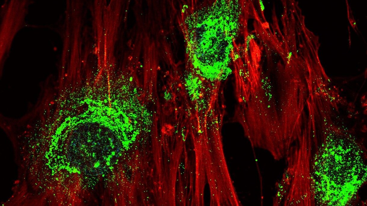cellule staminali adulte nel processo di trasformazione in cellule ossee dopo il trattamento con onde sonore ad alta frequenza. La colorazione verde mostra la presenza di collagene, che le cellule producono quando diventano cellule ossee / RMIT