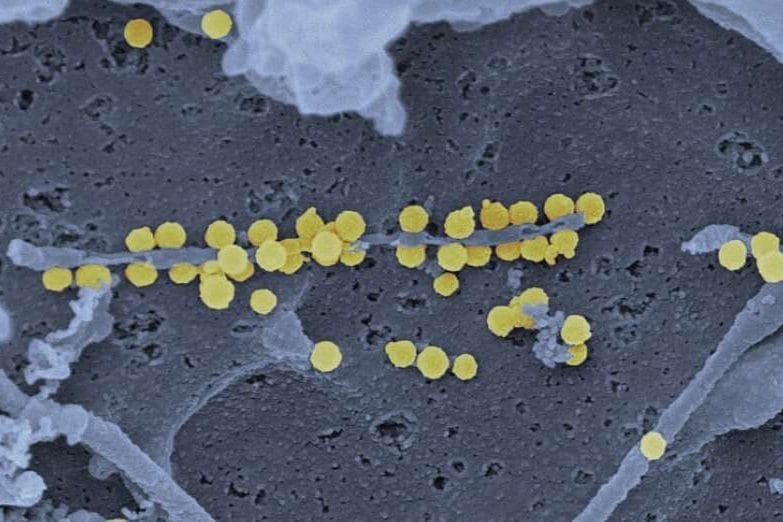 Particelle del virus che causano la febbre emorragica del Congo Crimea / NIAID