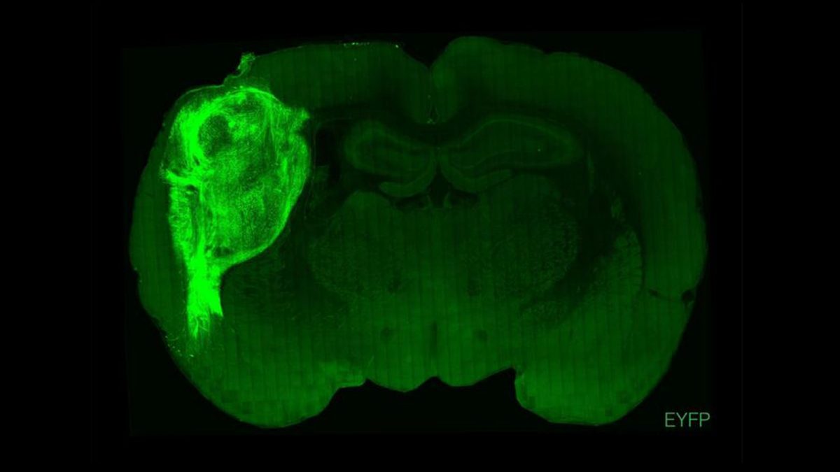 In verde più chiaro il tessuto cerebrale umano nel cervello del ratto. Credit: Università di Stanford.