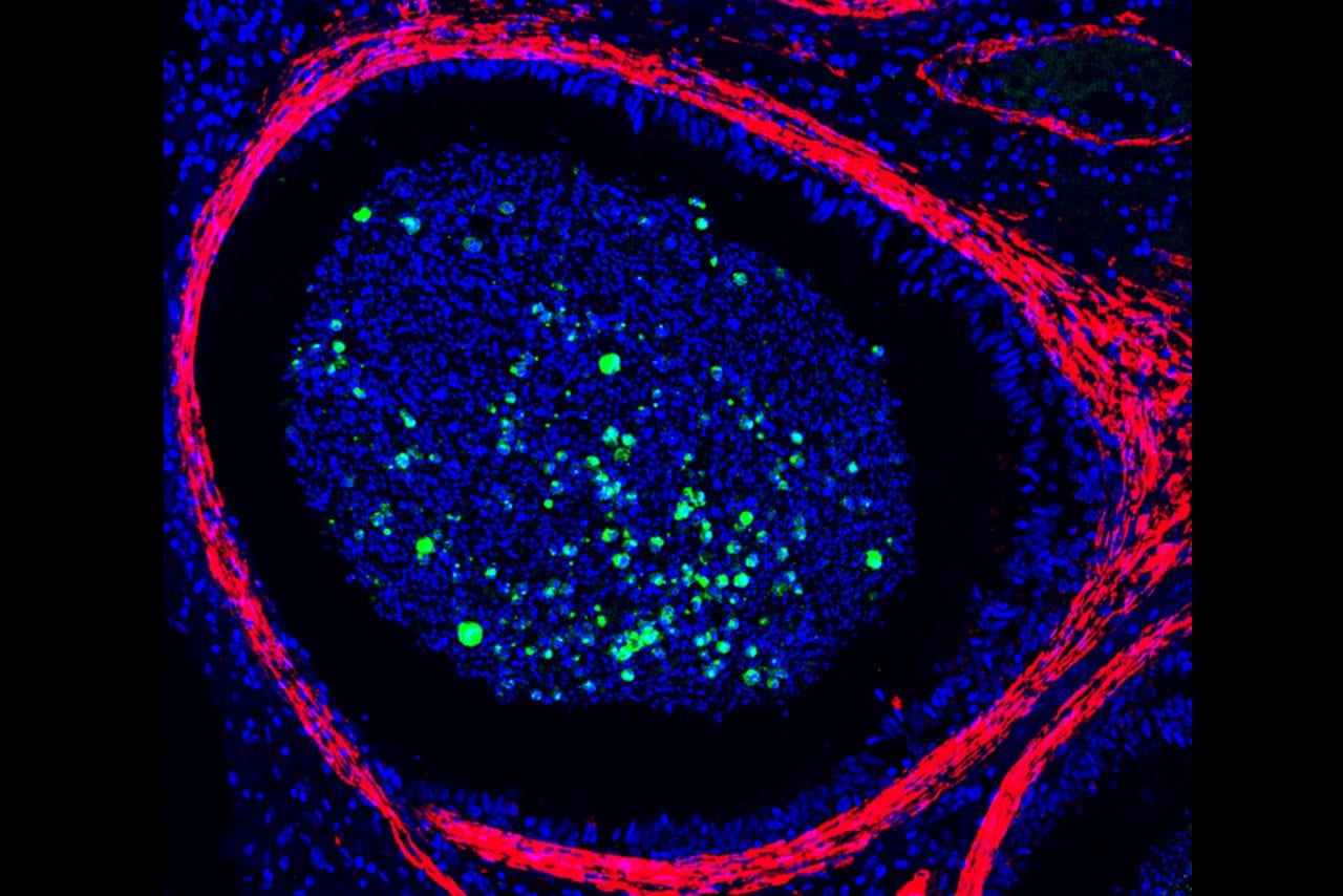 Il virus del vaiolo delle scimmie rilevato per la prima volta nei testicoli