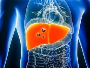 Cancro al fegato, drammatico aumento dei casi entro 25 anni: cause e come prevenire il tumore