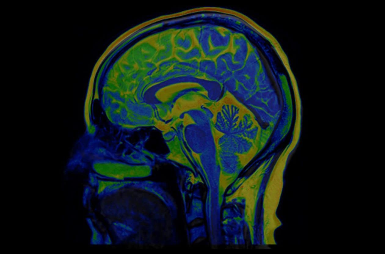 La pandemia di Covid ha fatto invecchiare il nostro cervello, anche senza infezione: lo studio