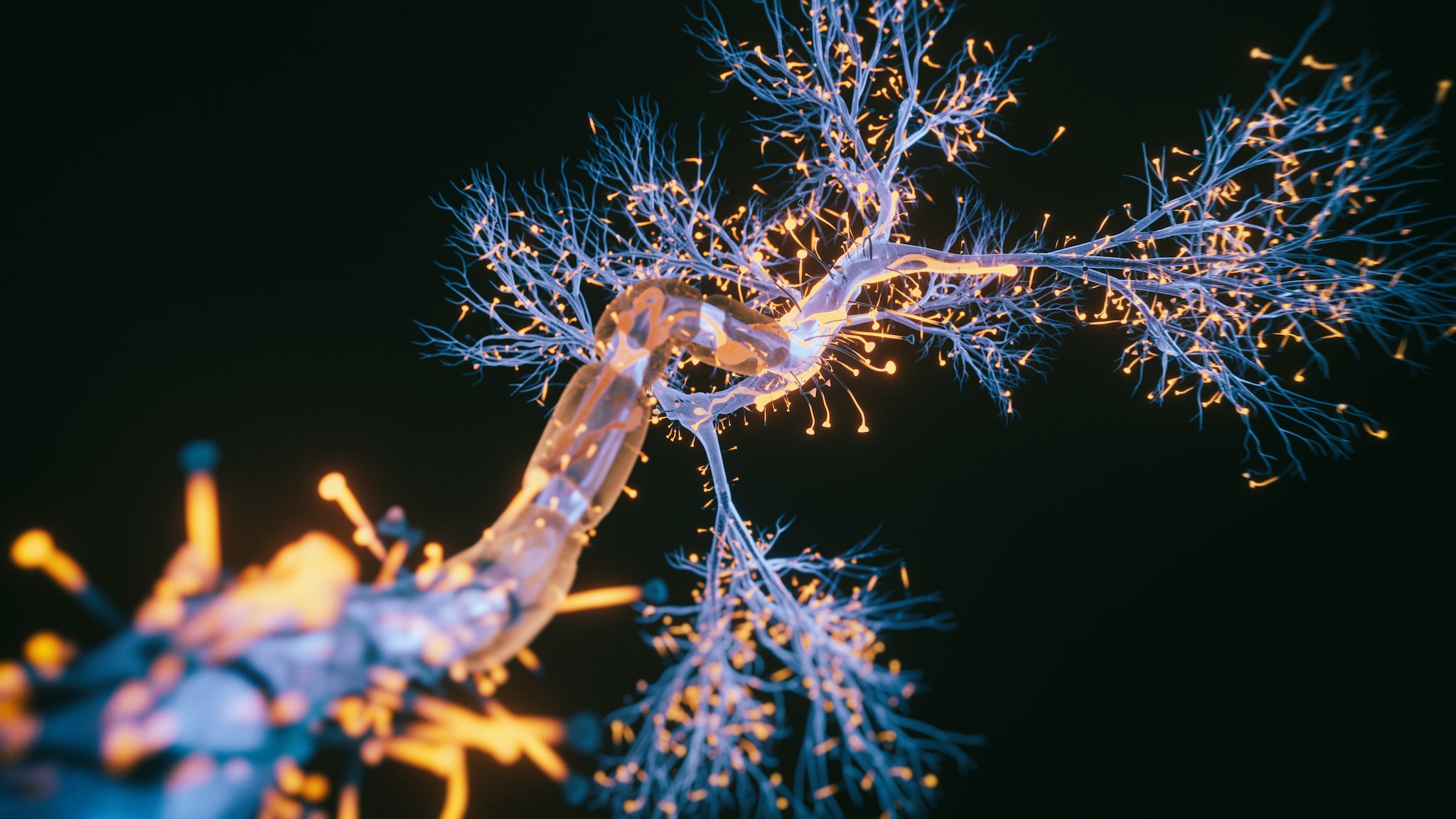 L’Alzheimer non inizia sempre allo stesso modo, esistono quattro strade d’esordio: cambiano sintomi e cure