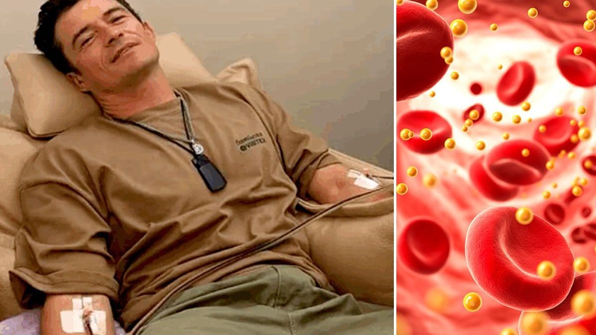 L’attore britannico Orlando Bloom si è sottoposto a aferesi nel tentativo di rimuovere le microplastiche dal sangue / Credit: Instagram/iStock