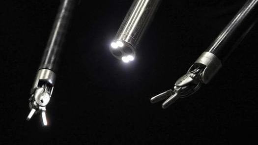 Robot ascolta le istruzioni vocali del chirurgo ed esegue intervento rivoluzionario: “Pietra miliare”