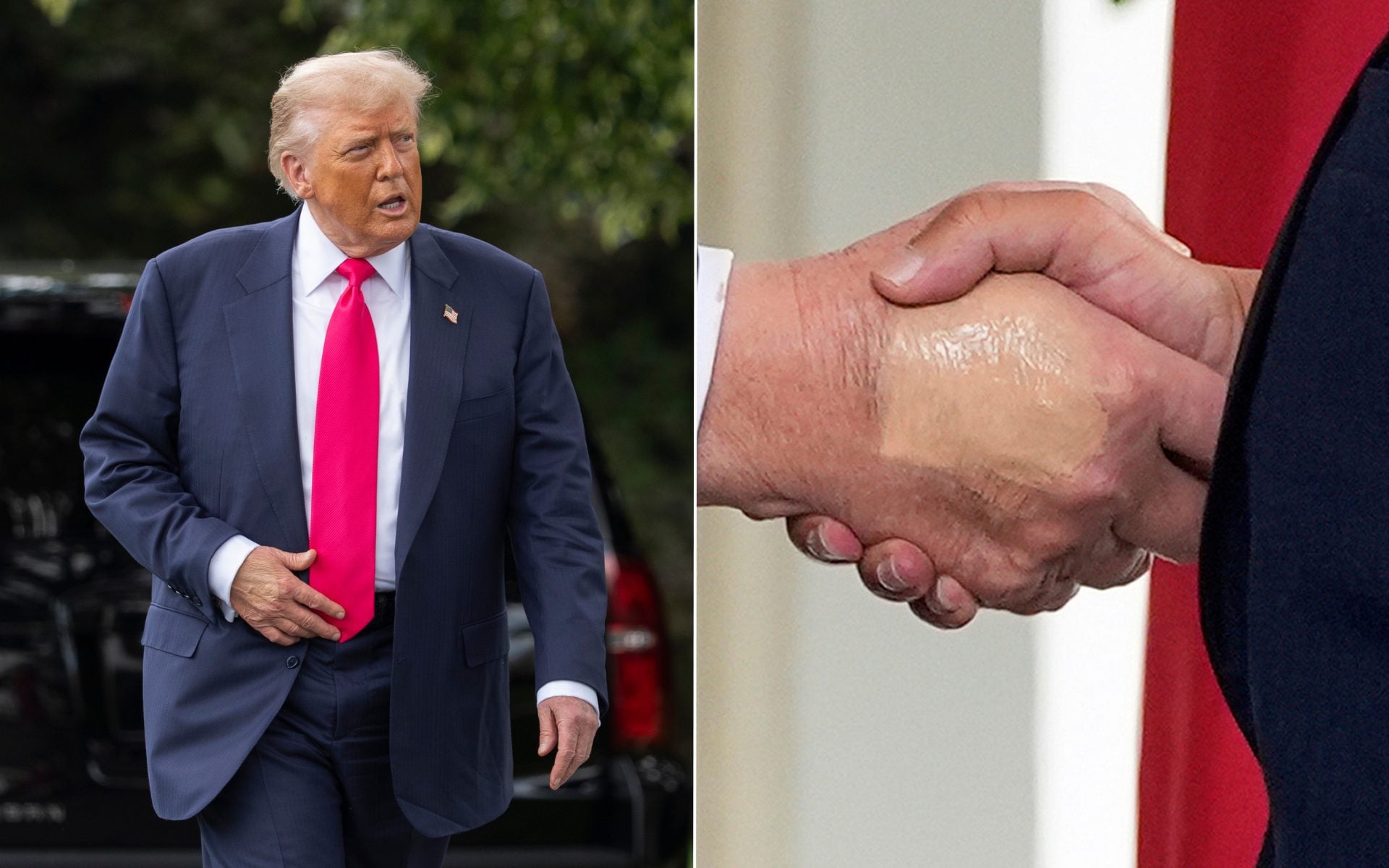 Perché Trump aveva una mano coperta di fondotinta: il motivo spiegato dalla Casa Bianca