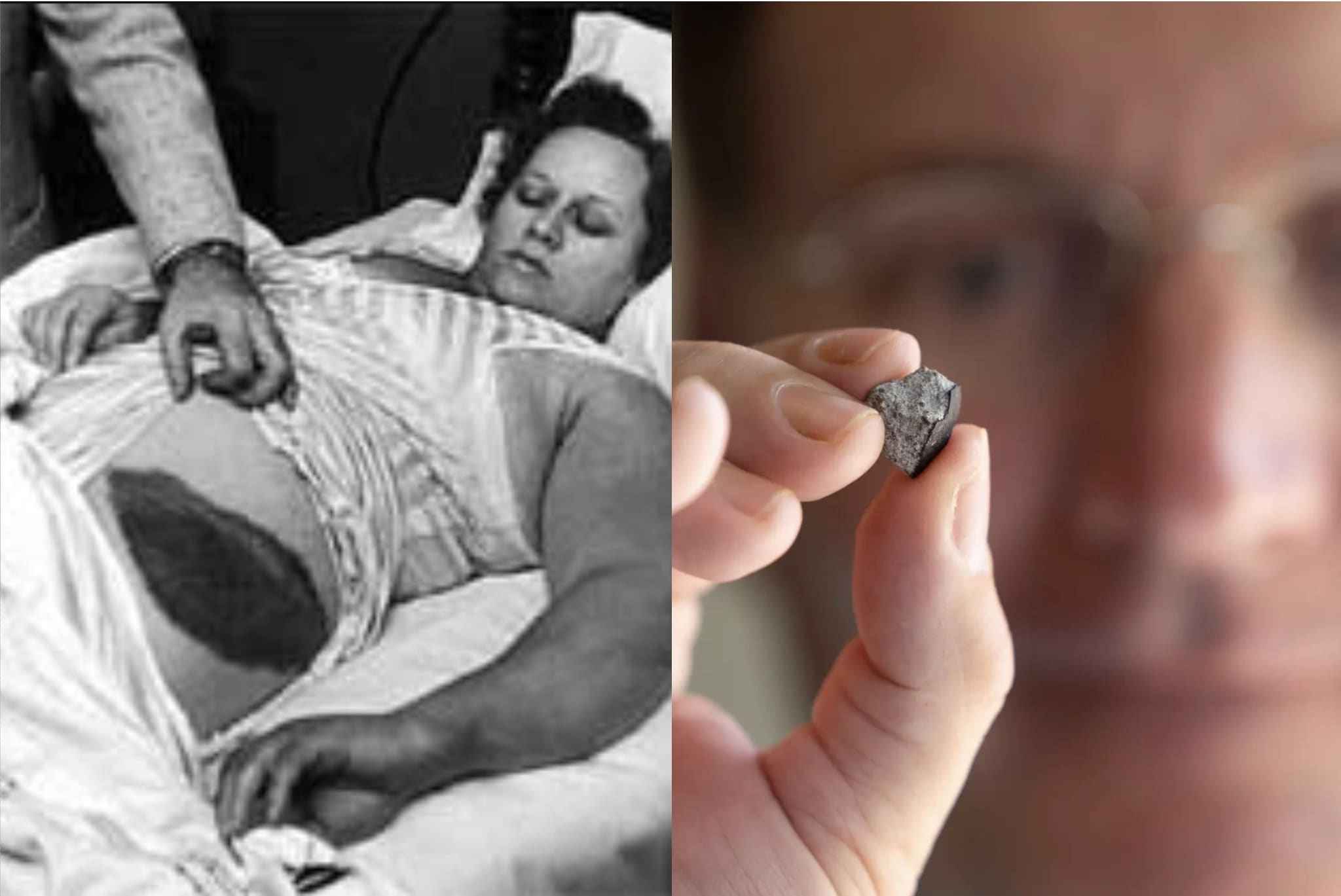 La storia dell’uomo sfiorato da un meteorite: poteva essere il secondo caso di impatto mai registrato