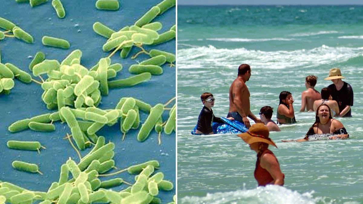 Batterio "mangia–carne" Vibrio vulnificus causa 10 morti lungo la costa atlantica degli Stati Uniti