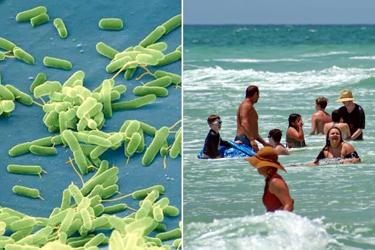 Batterio “mangia-carne”, 10 morti negli Usa: si contrae in acqua di mare o salmastra e con molluschi crudi