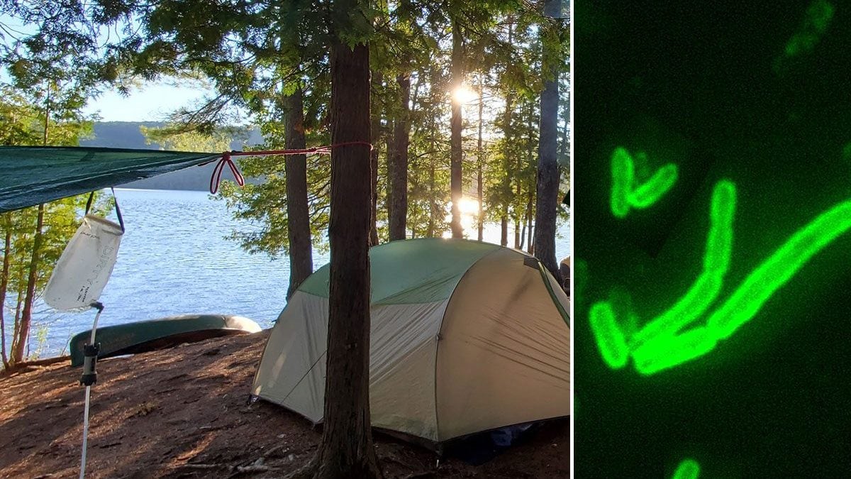 In California un uomo è risultato positivo alla peste dopo aver soggiornato in un campeggio sul lago Tahoe. A destra, Yersinia pestis, il batterio responsabile della malattia / Credit: iStock/Wikipedia