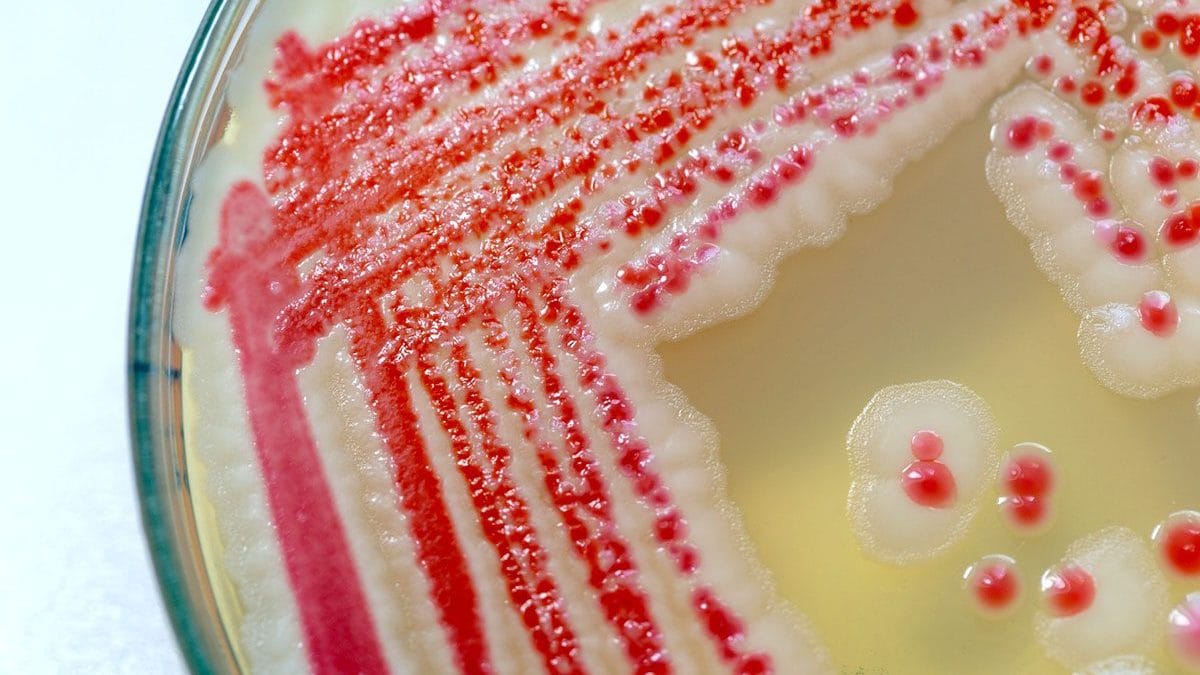 Colonie di batteri Serratia marcenscens su piastra / Credit: iStock
