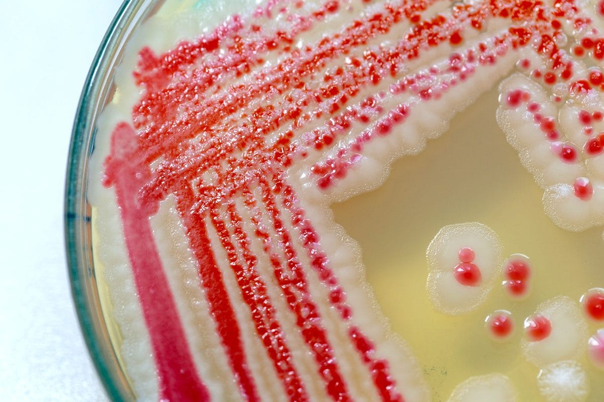 Neonati morti a Bolzano per infezione da batterio Serratia, cos’è e perché colpisce i più piccoli