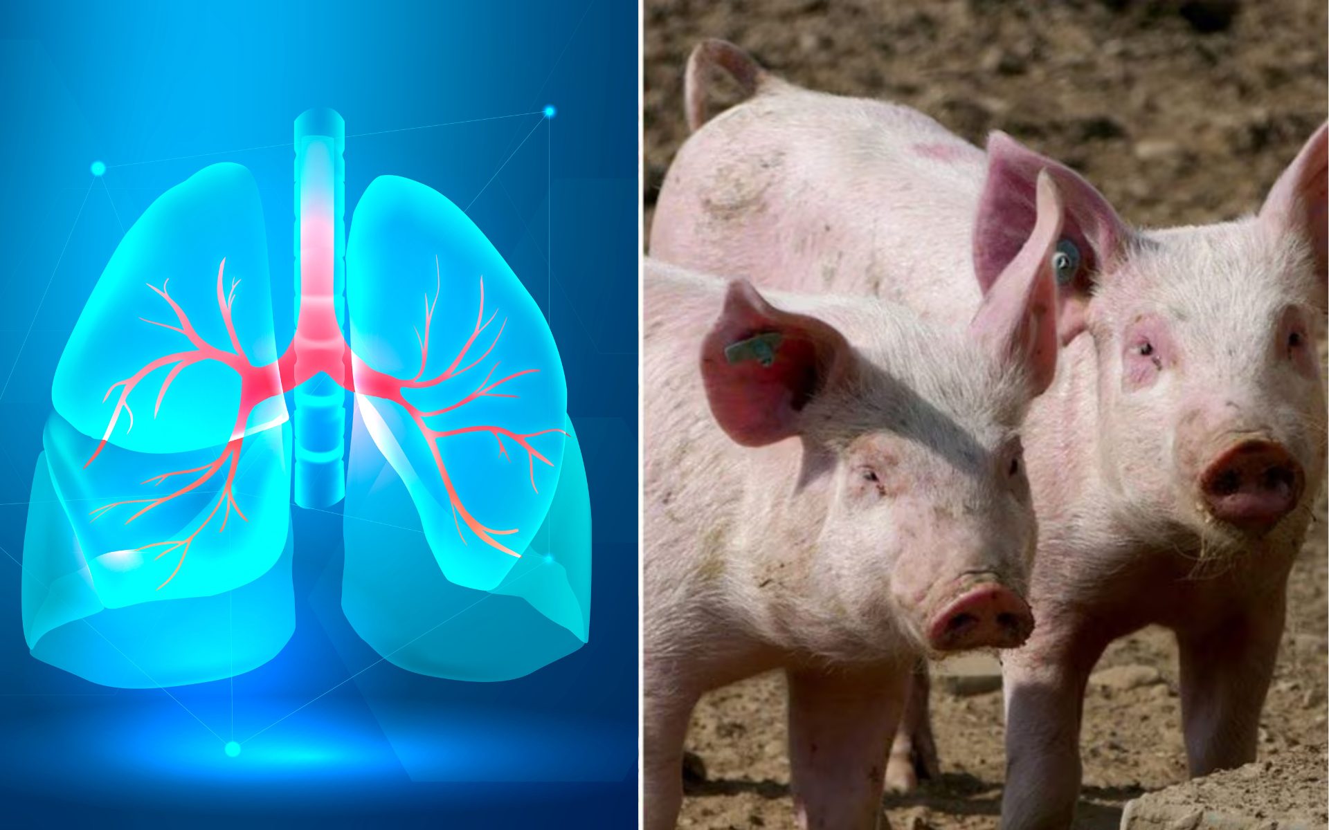 Un polmone di maiale è stato trapiantato in un essere umano: è la prima volta nella storia