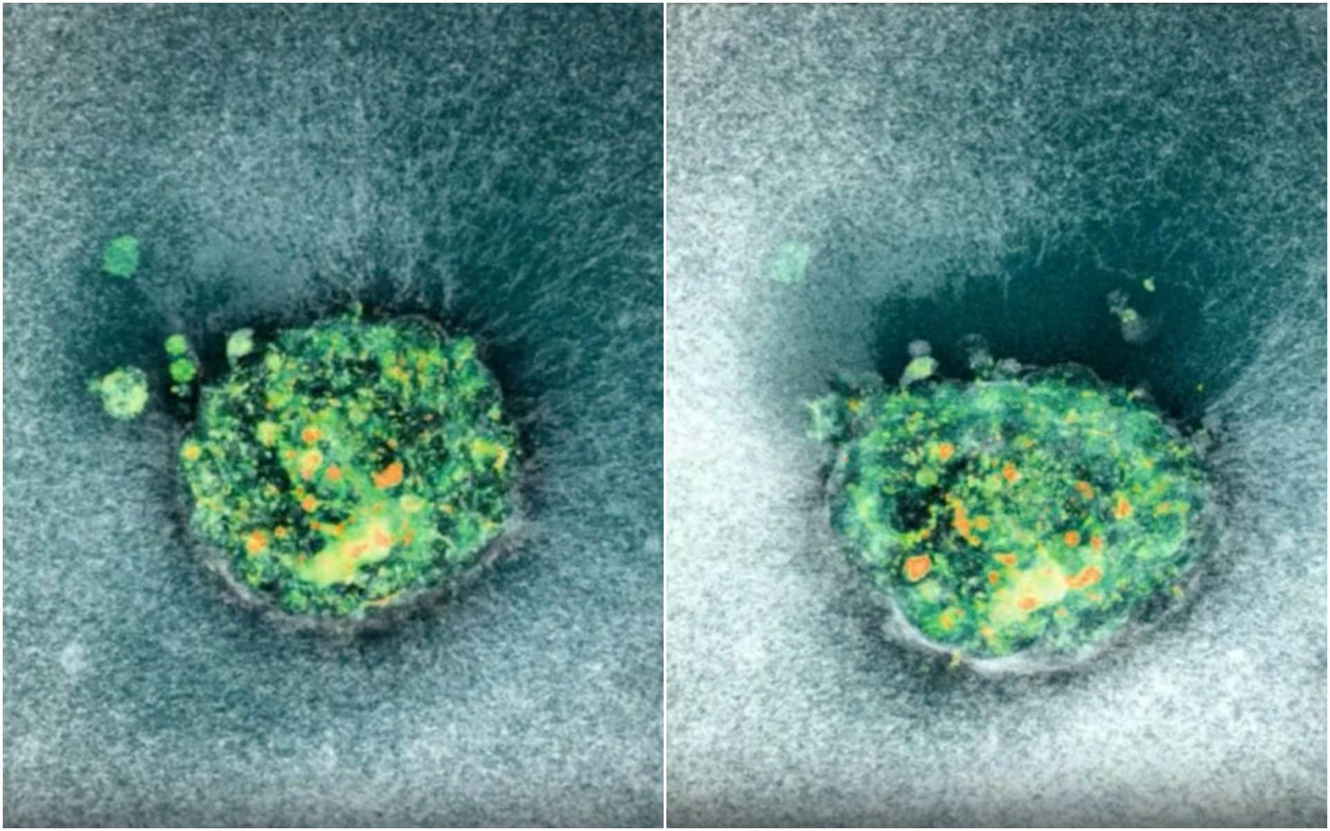 Per la prima volta abbiamo visto come avviene l'impianto di un embrione: le immagini in tempo reale