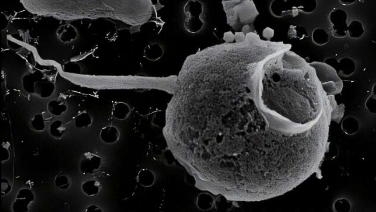 Il virus PelV–1. Credit: Gajigan et al / bioRxiv