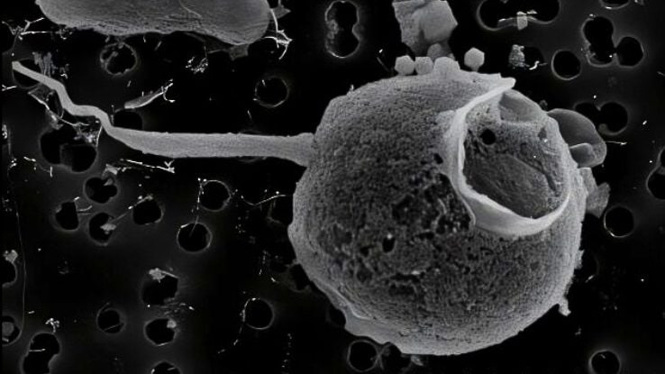 Scoperto un misterioso virus gigante dalla coda lunghissima: cosa sappiamo su PelV-1