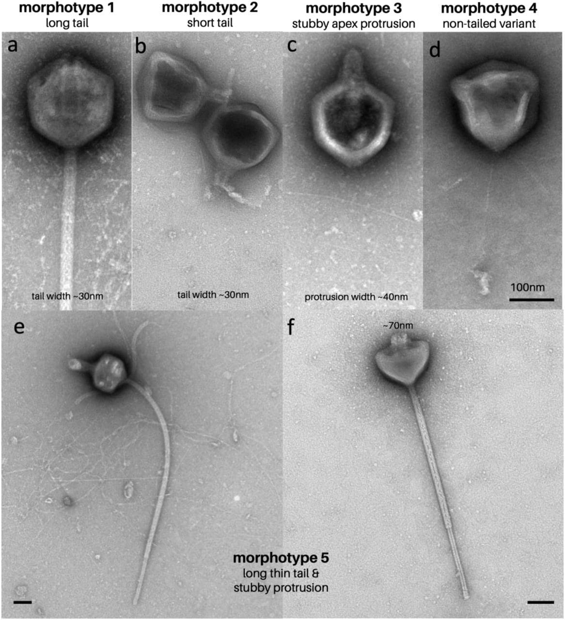 Particelle virali di PelV–1. Credit: Gajigan et al / bioRxiv