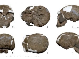 cranio-yunxian-2-300x225.jpg