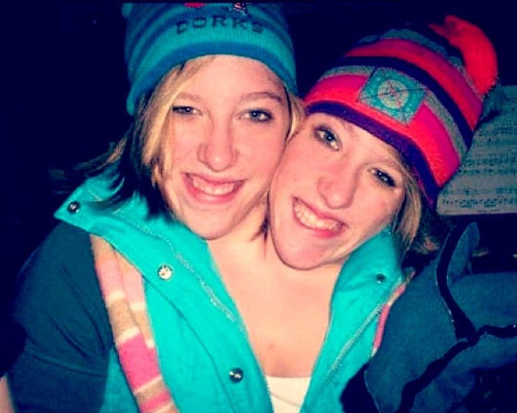 Abby e Brittany Hansel, come vivono le gemelle siamesi con due teste e un corpo