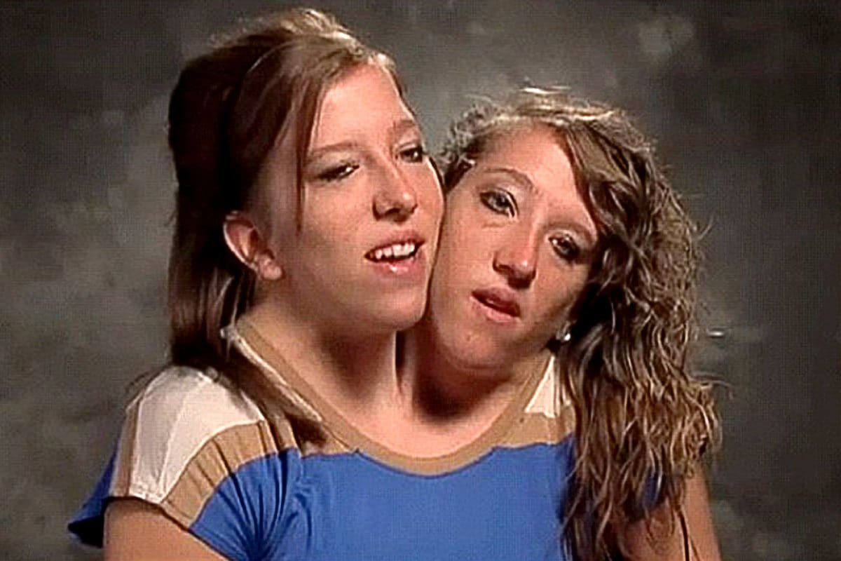 Le gemelle siamesi Abby e Brittany Hansel / TLC