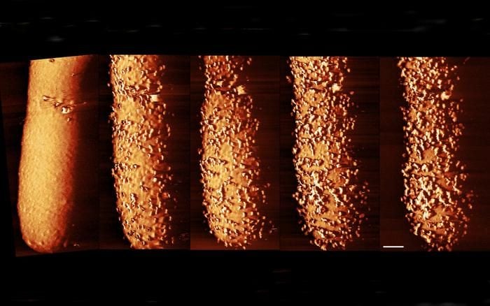 Immagini straordinarie mostrano come gli antibiotici uccidono i batteri resistenti: perché è una svolta