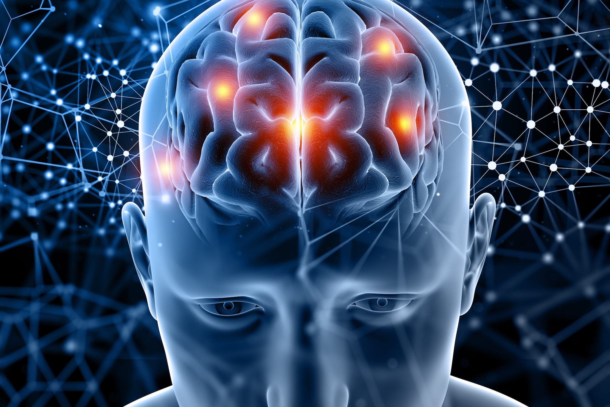 Un casco a ultrasuoni per trattare i sintomi motori del Parkinson: il progetto di uno studio decennale