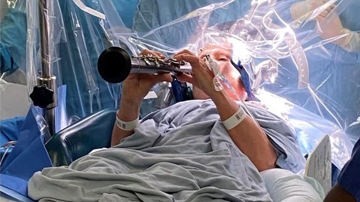 Denise Bacon, 65 anni, suona il clarinetto durante un delicato intervento chirurgico al cervello per ridurre i sintomi del Parkinson / Credit: King’s College Hospital