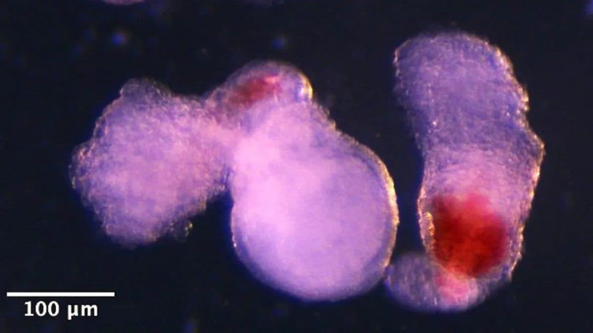 Due ematoidi con il sangue rosso ben visibile a occhio nudo. Credit: Università di Cambridge