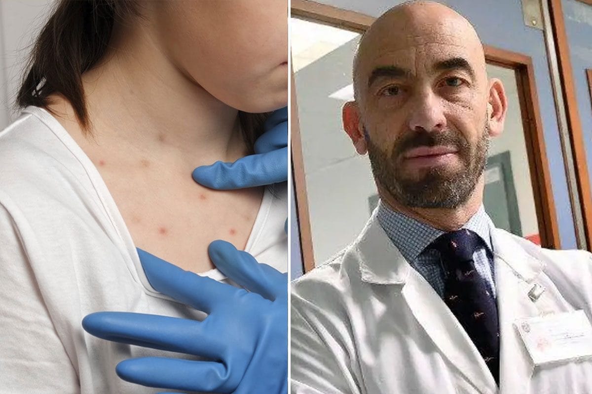 Morbillo, casi record negli Stati Uniti: oltre 150 bambini in quarantena, Bassetti: “Tornati agli anni ‘70”